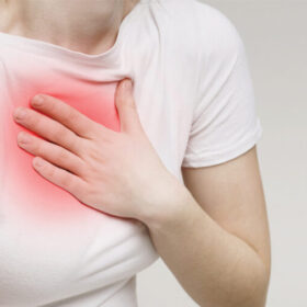 Acid Reflux